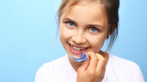 Apparecchi dentali per bambini
