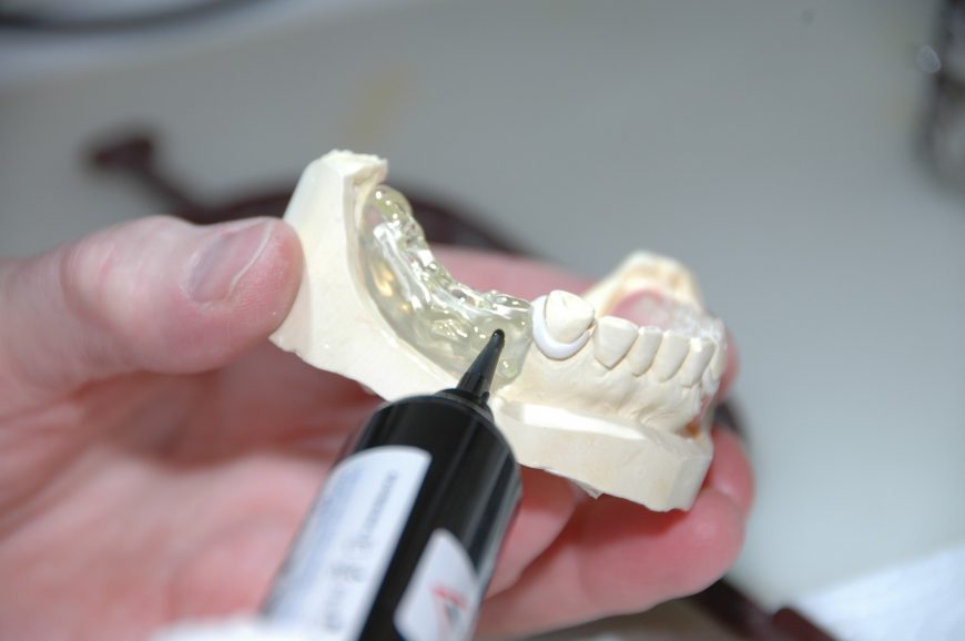 protesi dentarie ultima generazione